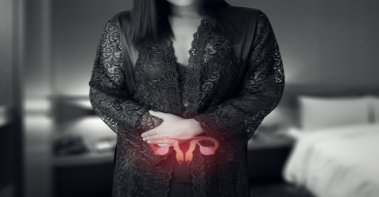 Was sind Schokoladenzysten (Endometriose)?