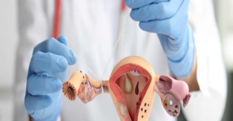 Wenn ich meine Eileiter unterbinden lasse, besteht dann die Möglichkei